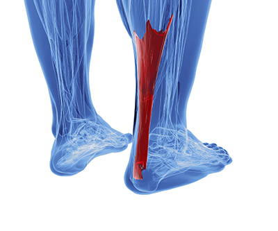 achilles tendon