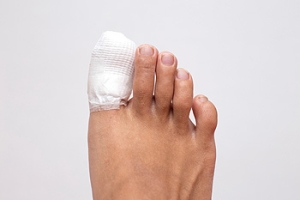 How Are Toe Fractures Treated?